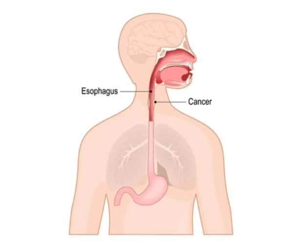 Human body diagram