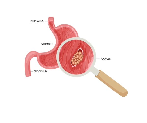 Duodenum