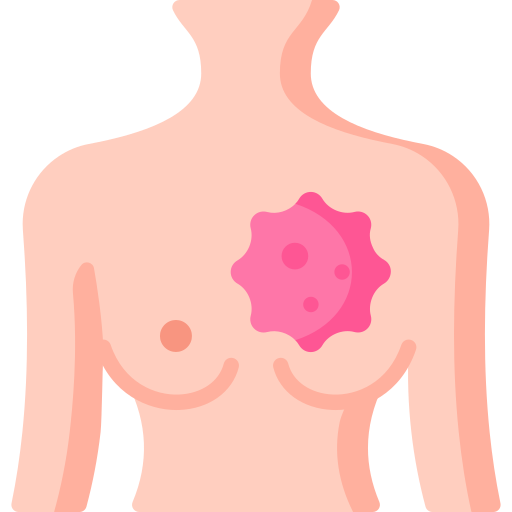 Robotic Breast Cancer Surgery