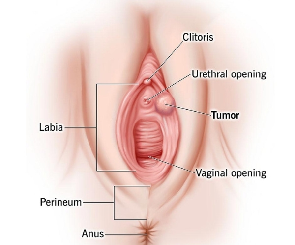 Urethral Opening