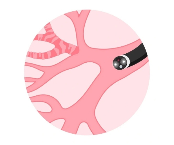 Mediastinal Cancer Diagram photo