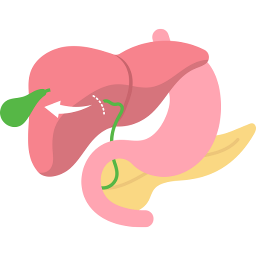 Simple Cholecystectomy