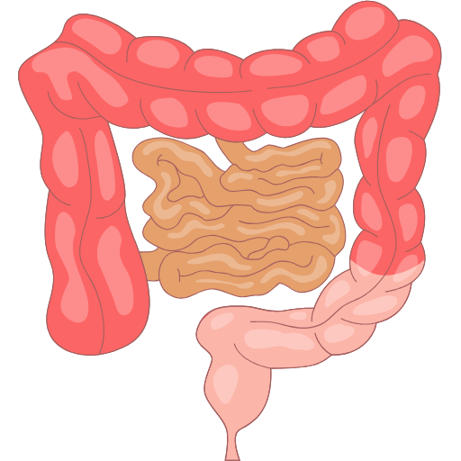 Subtotal Gastrectomy