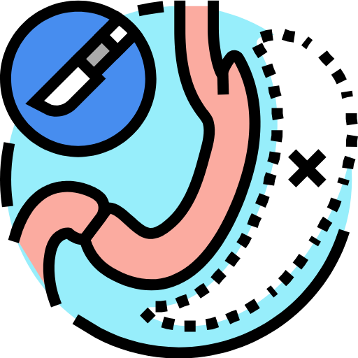 Robotic Gastrectomy