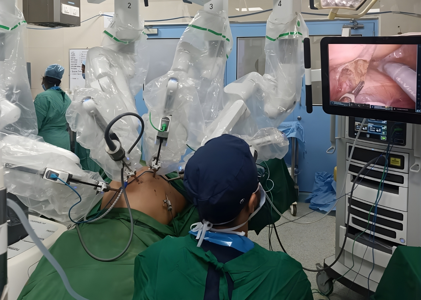 Robotic Cancer Surgeon in India