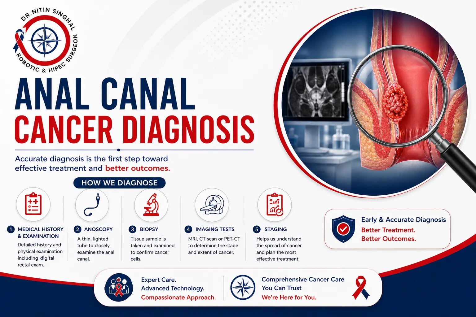 Anal canal cancer diagnosis illustration