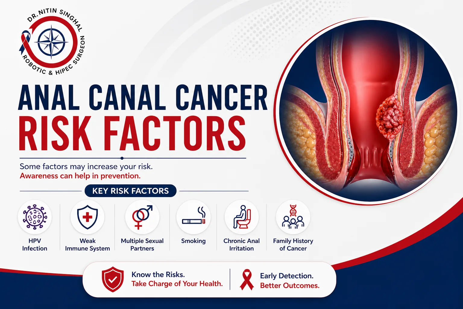 Anal canal cancer risk factors illustration