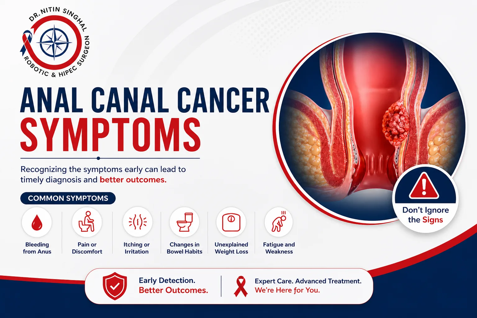 Anal canal cancer symptoms illustration