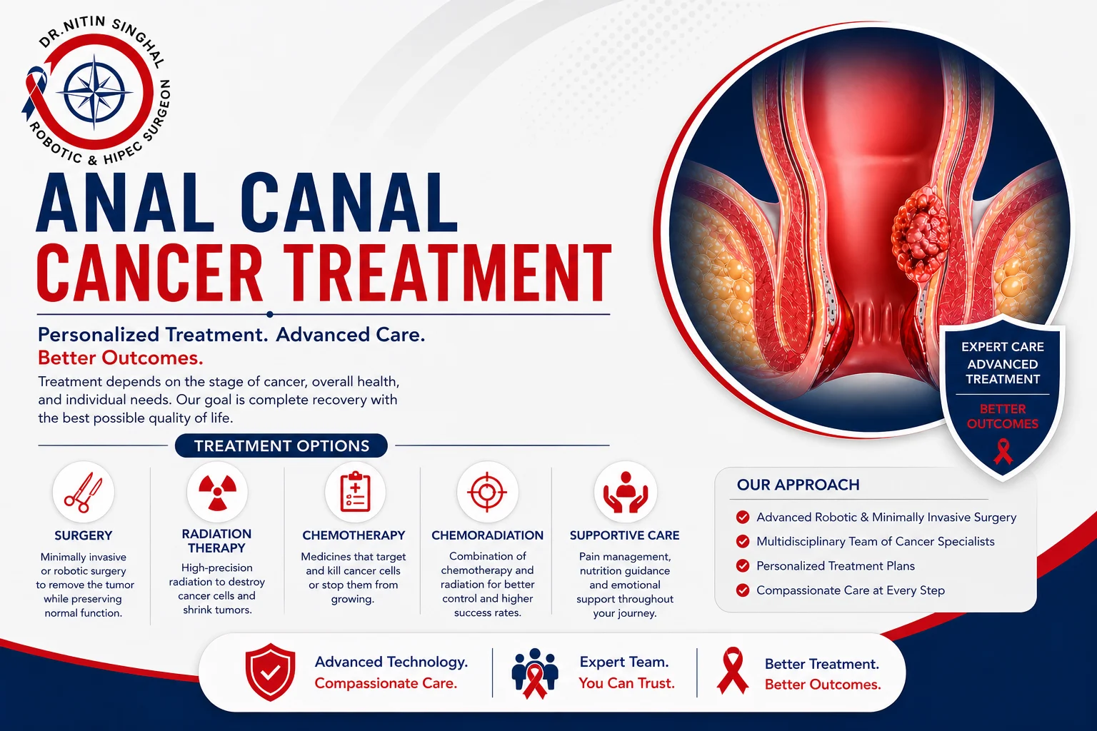 Anal canal cancer treatment options illustration