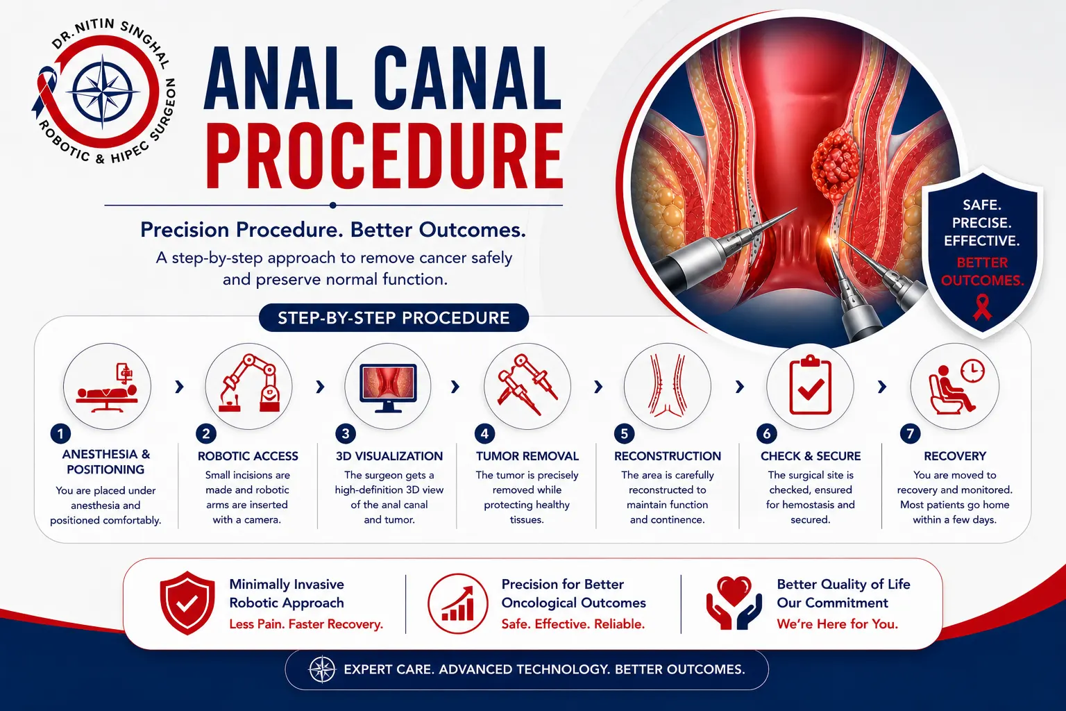 Anal canal cancer procedure types illustration