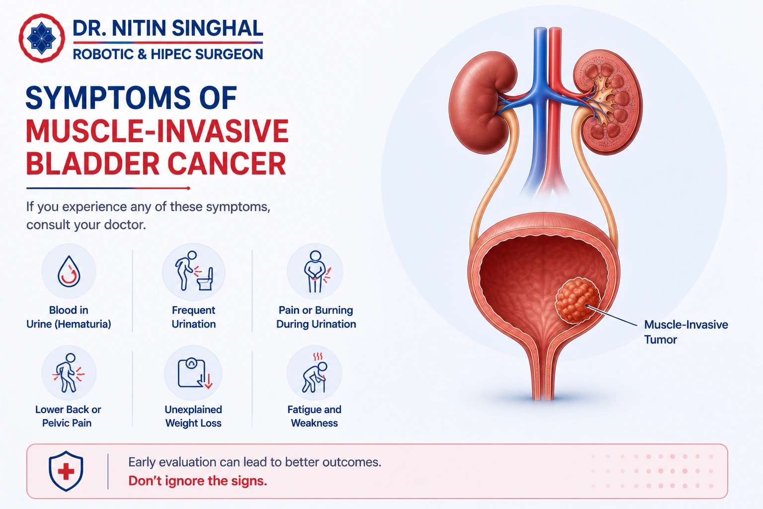Common symptoms of bladder cancer