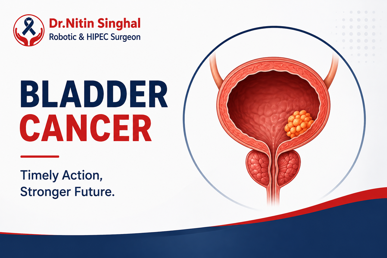 Urinary Bladder Cancer treatment icon