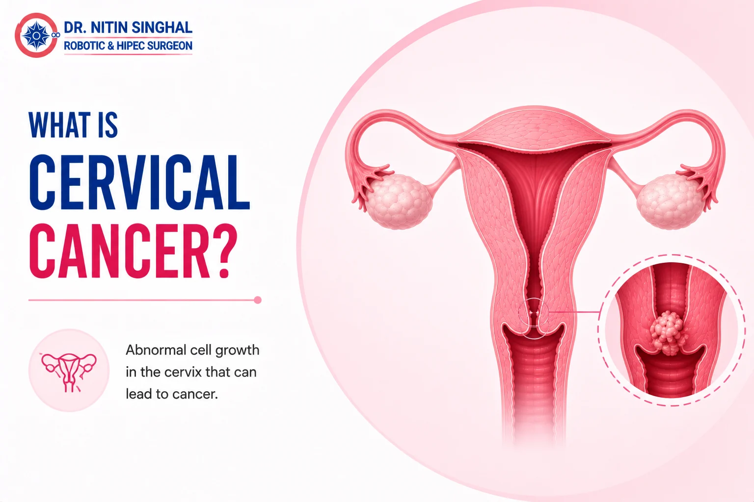 Cervix anatomy — robotic cervical cancer surgery, Dr. Nitin Singhal, Ahmedabad