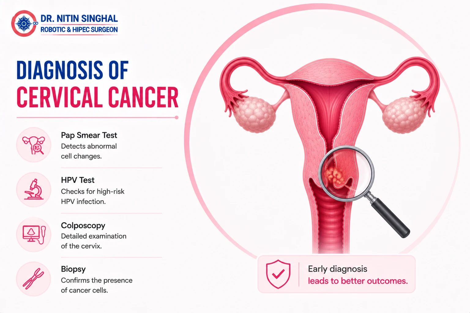 Cervical cancer diagnosis illustration
