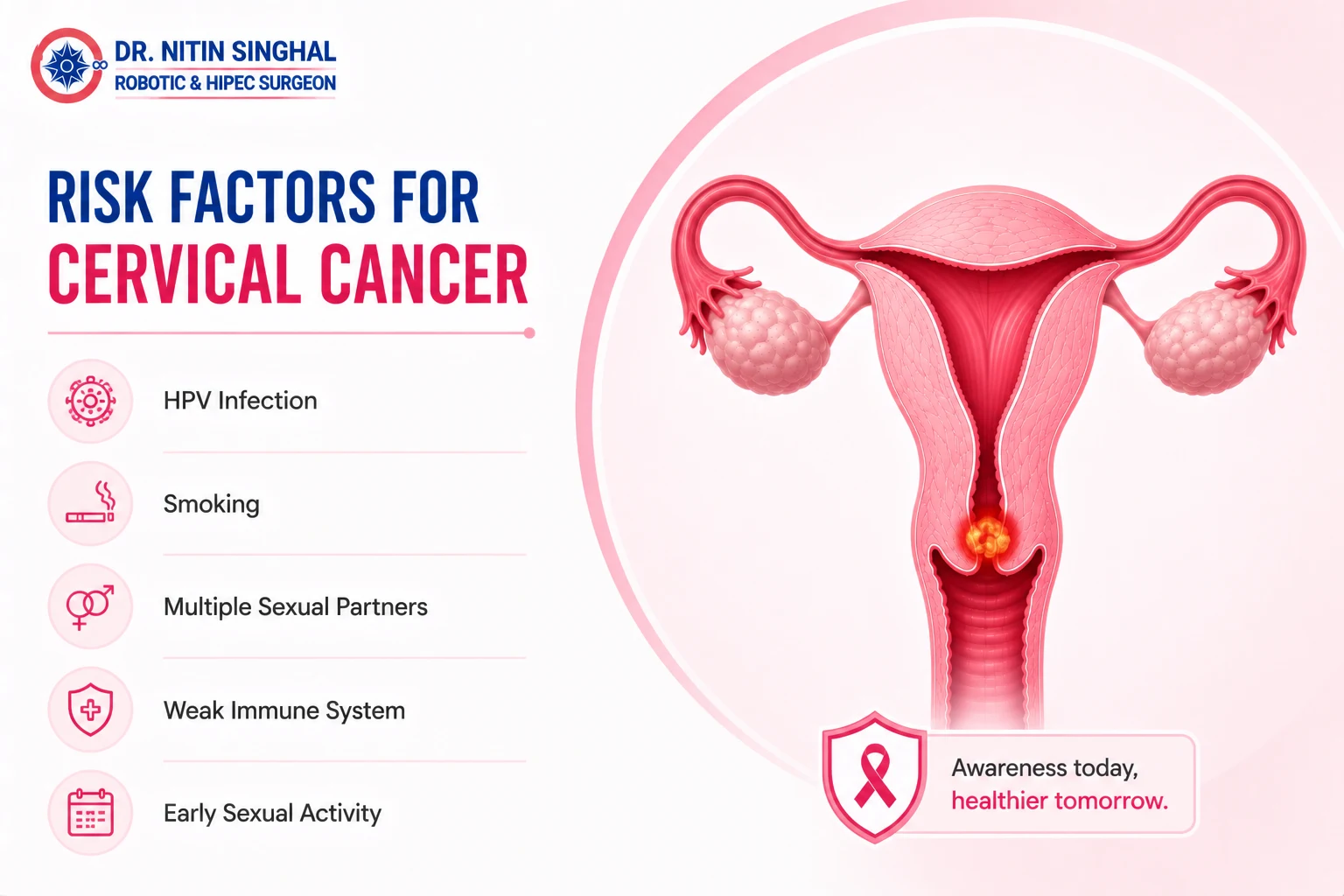 Cervical cancer risk factors illustration