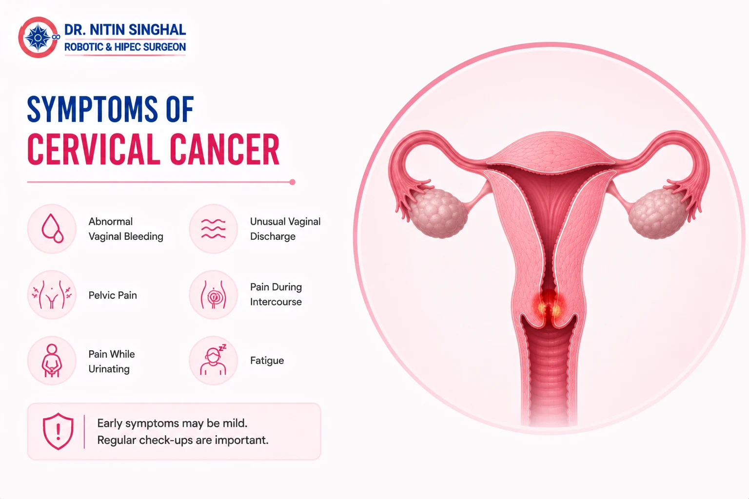 Cervical cancer symptoms illustration