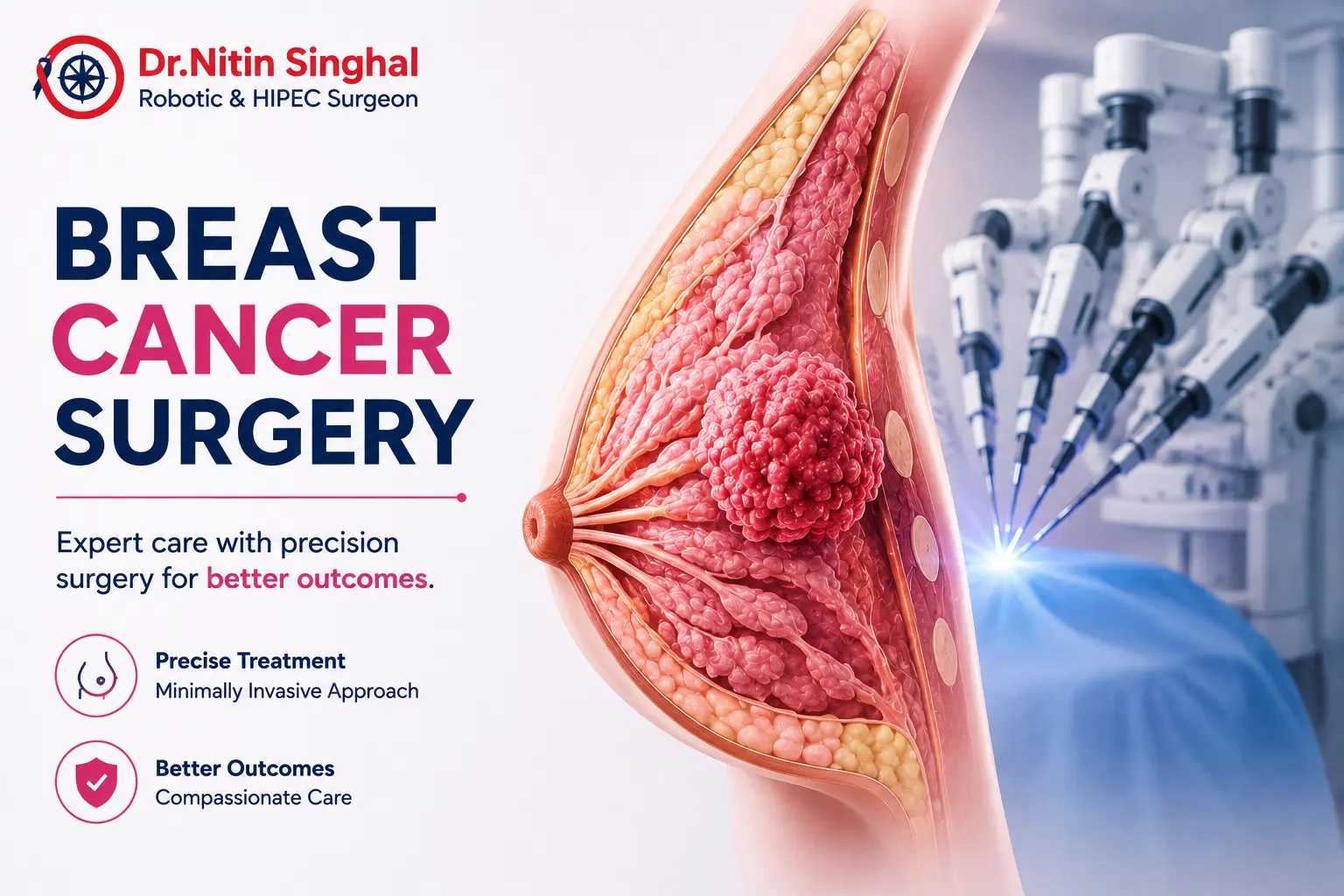 Breast Cancer Surgery, Dr Nitin Singhal Ahmedabad