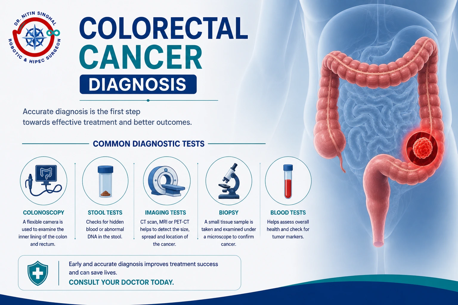 Colorectal cancer diagnosis illustration