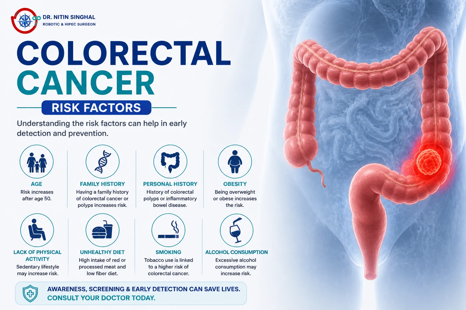 Colorectal cancer risk factors illustration