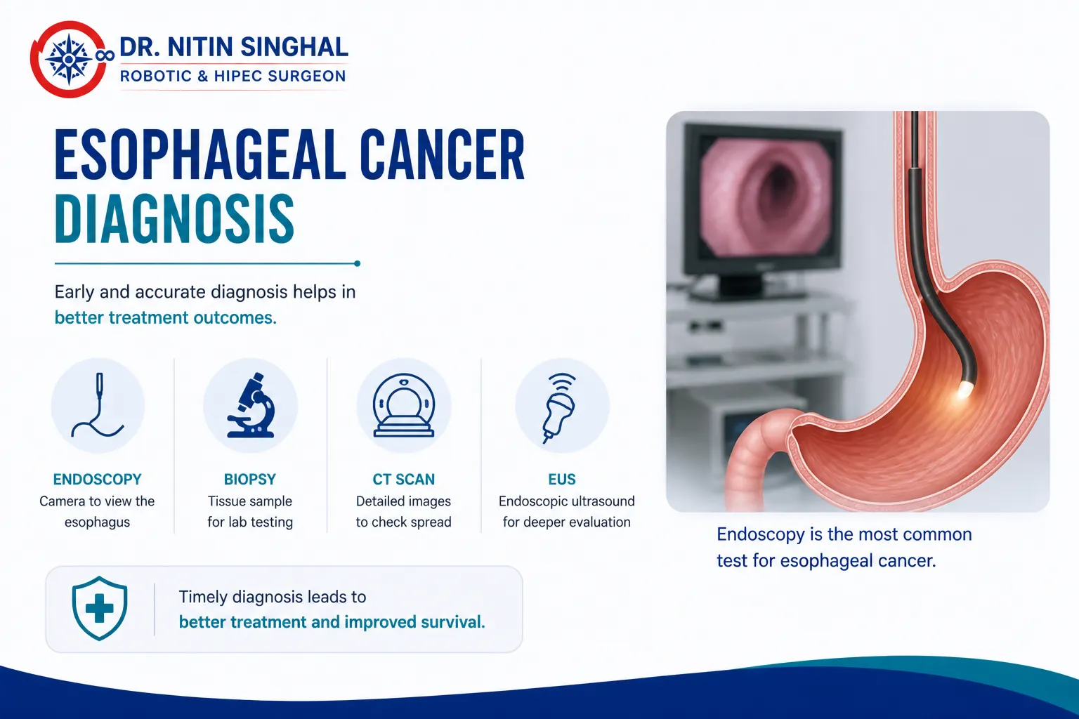 Esophageal cancer diagnosis illustration
