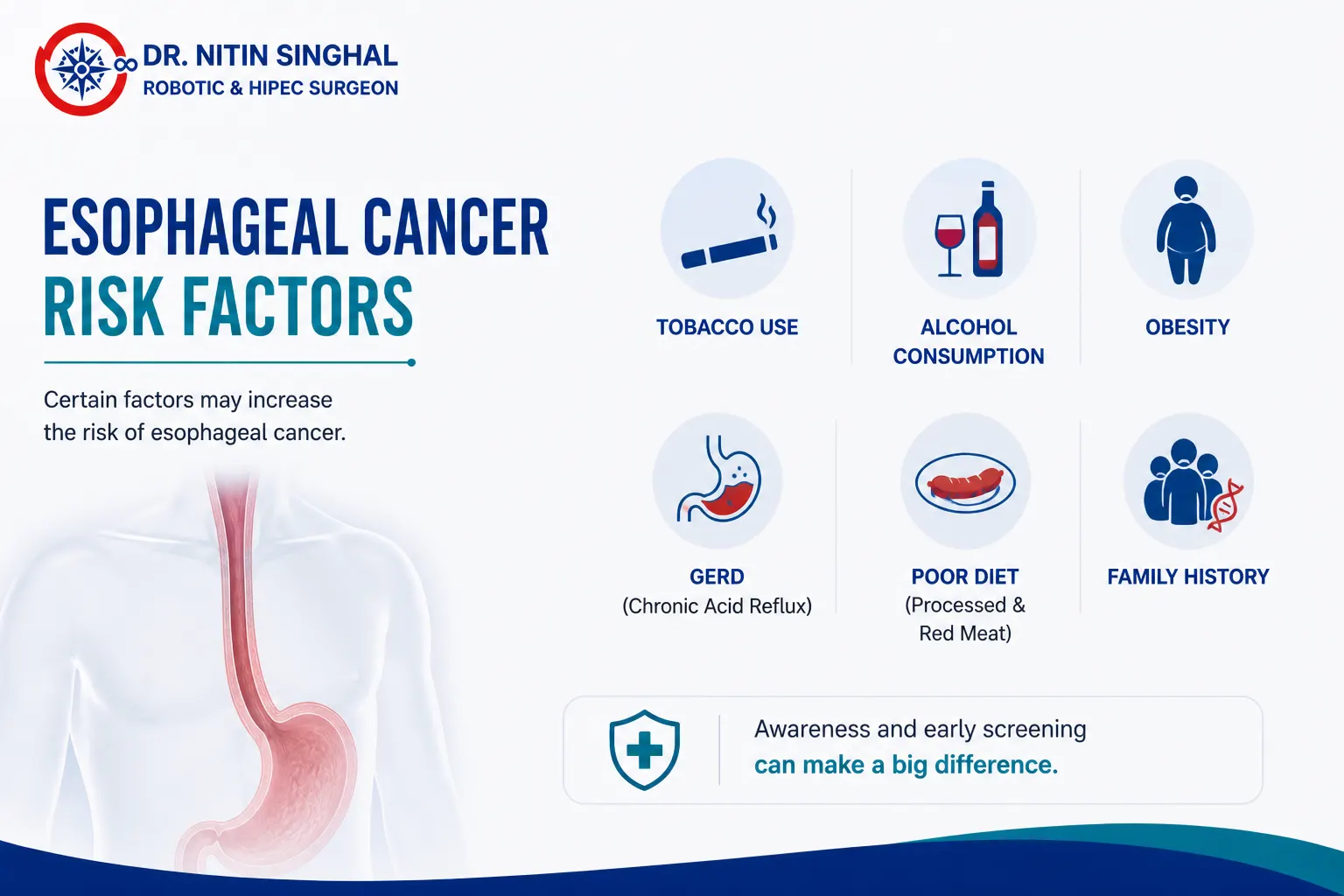 Esophageal cancer risk factors illustration