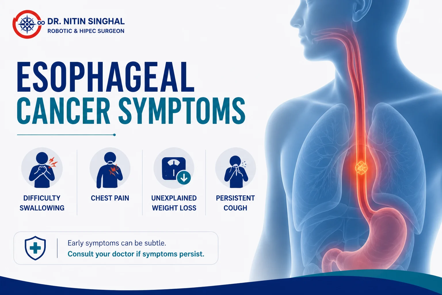 Esophageal cancer symptoms illustration