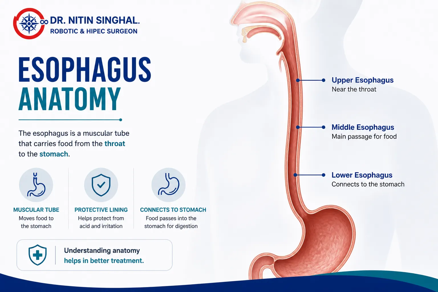 Robotic esophageal cancer surgery — Dr. Nitin Singhal, Ahmedabad