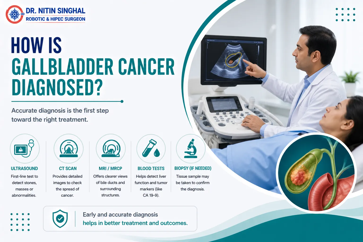 Gall bladder cancer diagnosis illustration