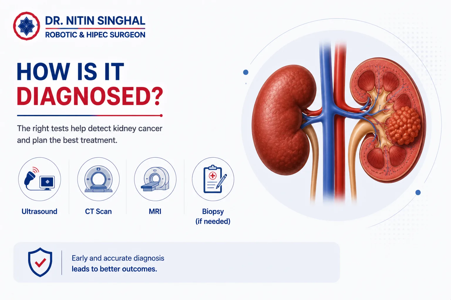 Kidney cancer diagnosis illustration