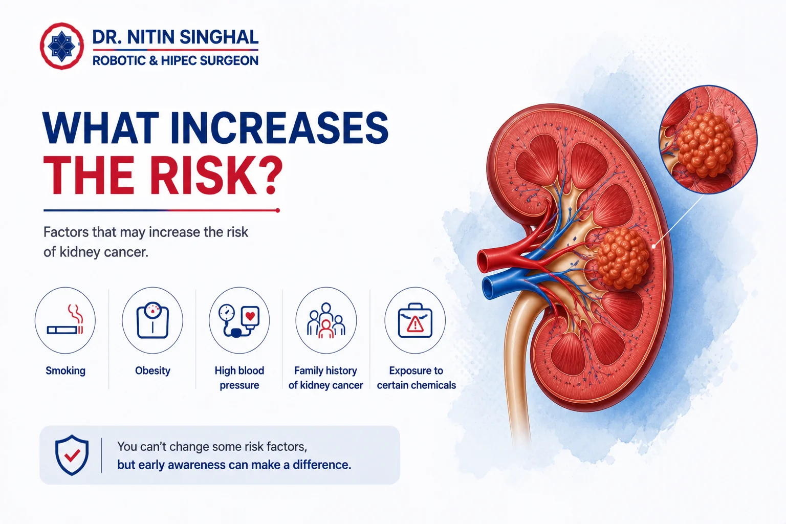 Kidney cancer risk factors illustration