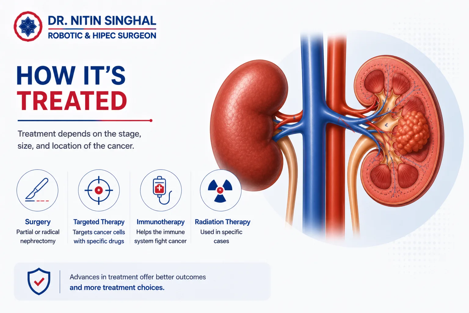 Kidney cancer treatment options illustration