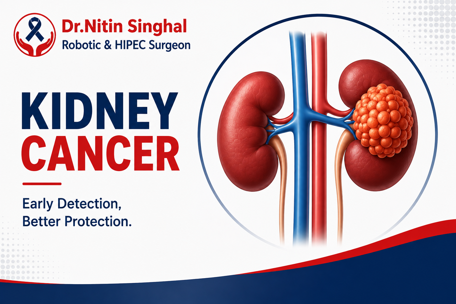 Kidney Cancer treatment icon