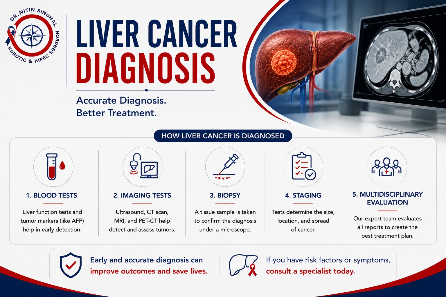 Liver cancer diagnosis illustration