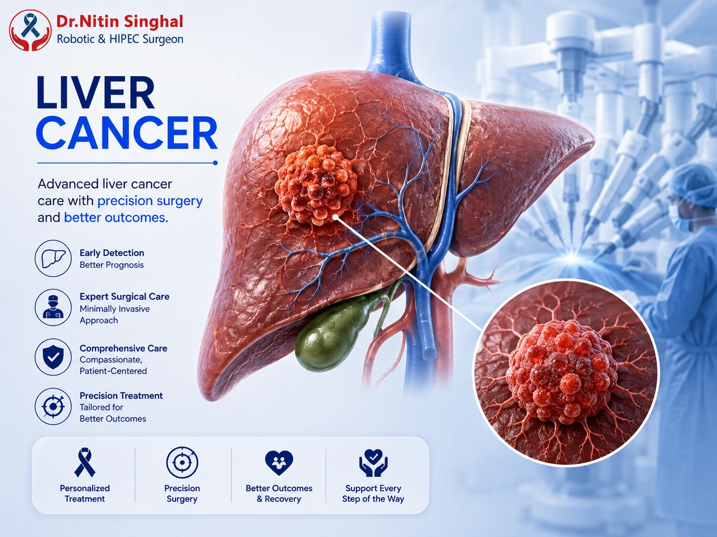 Liver cancer illustration - tumour in the liver, Dr. Nitin Singhal Robotic and HIPEC Surgeon