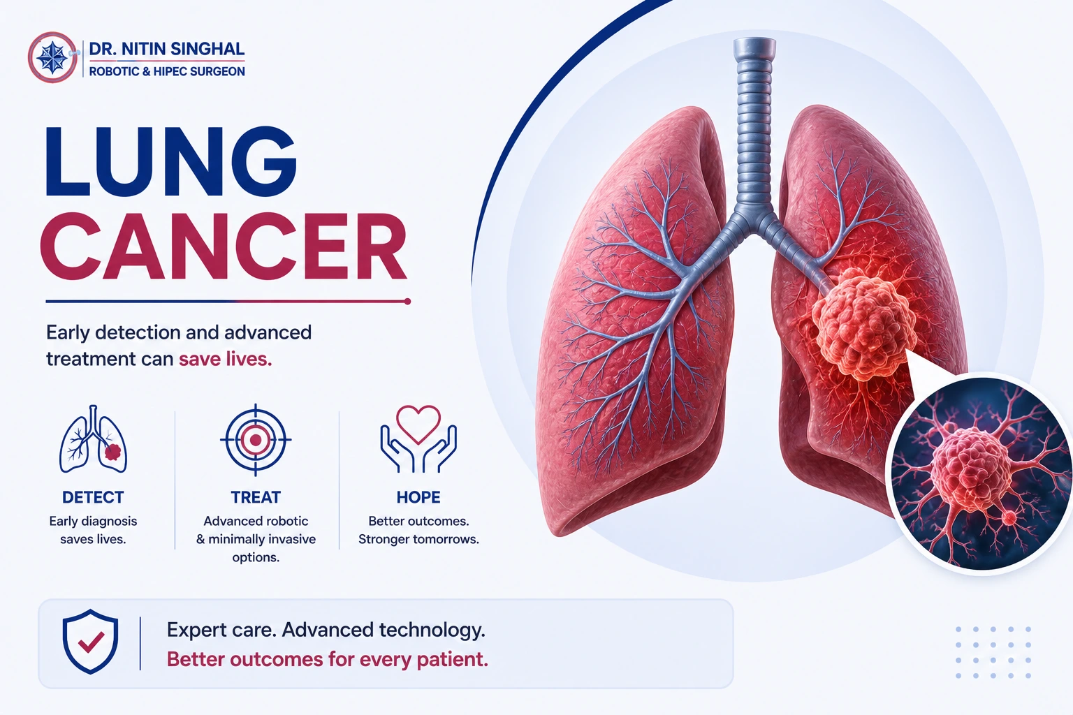 Lung anatomy — robotic lung cancer surgery, Dr. Nitin Singhal, Ahmedabad