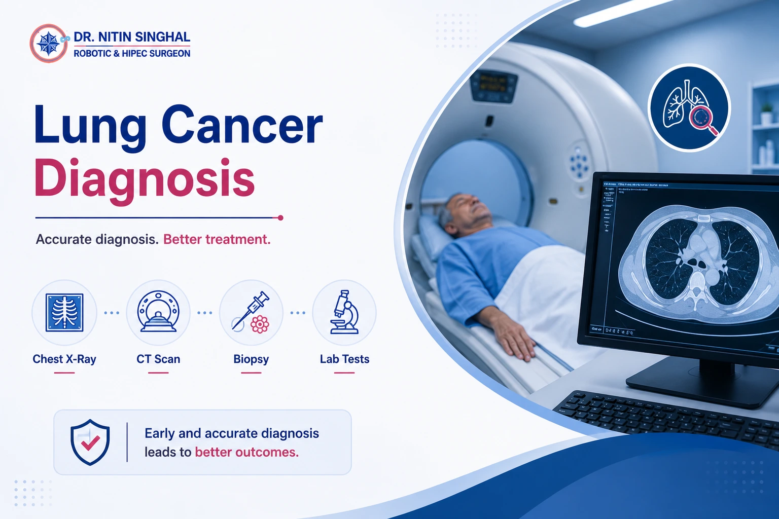 Lung cancer diagnosis illustration