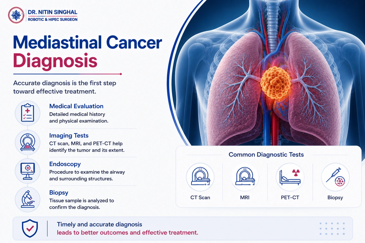 Mediastinal cancer diagnosis illustration
