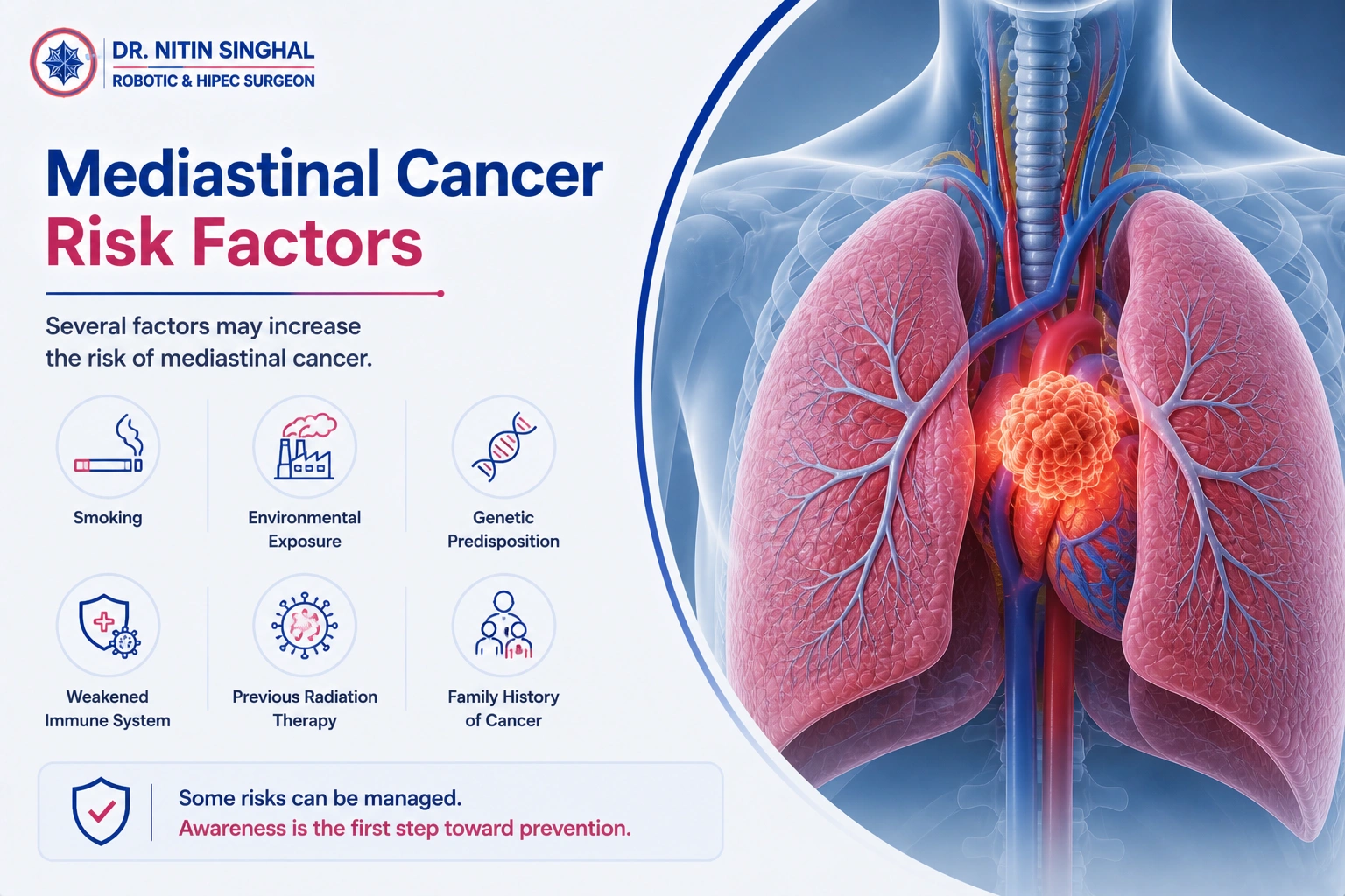 Mediastinal cancer risk factors illustration