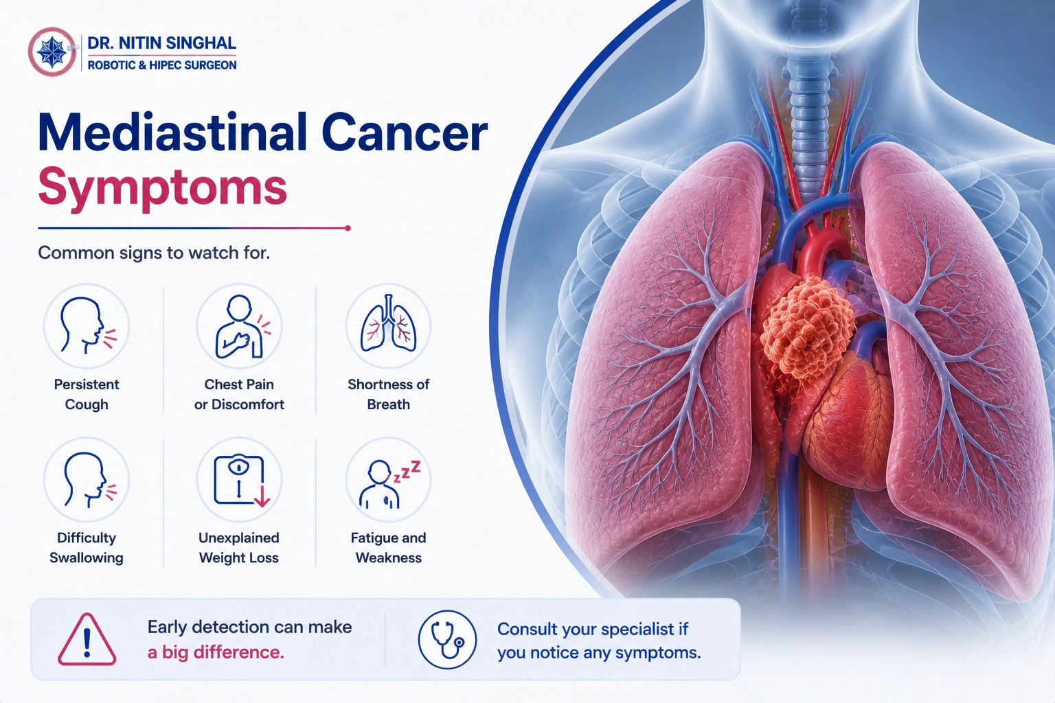 Mediastinal cancer symptoms illustration
