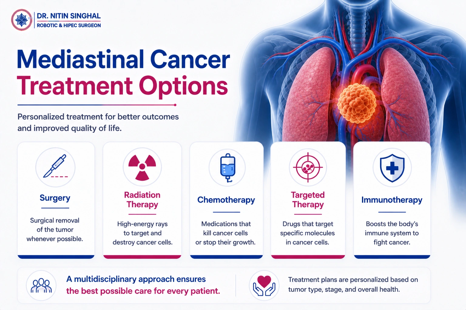 Mediastinal cancer treatment options illustration