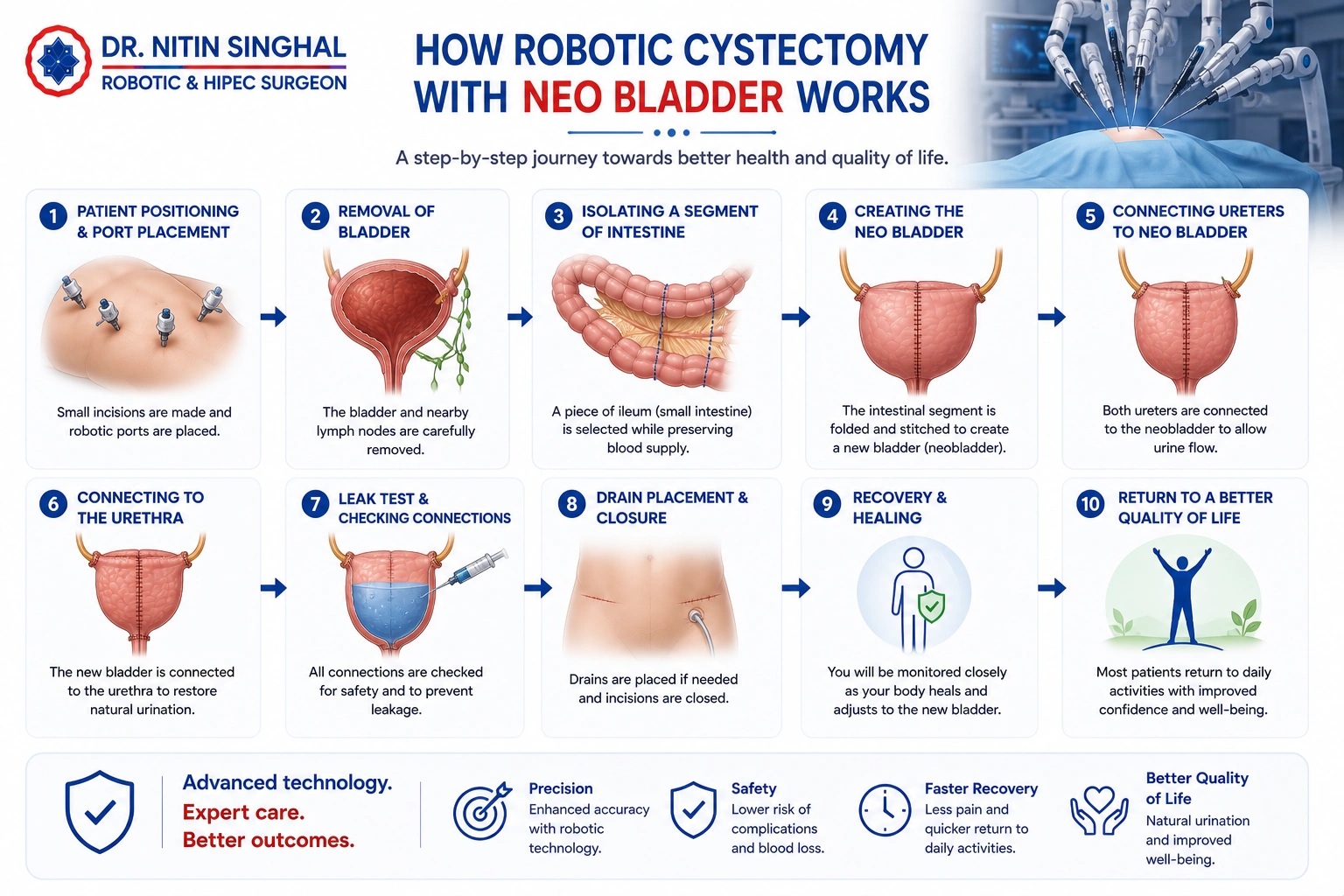 Step by step overview of neobladder surgery