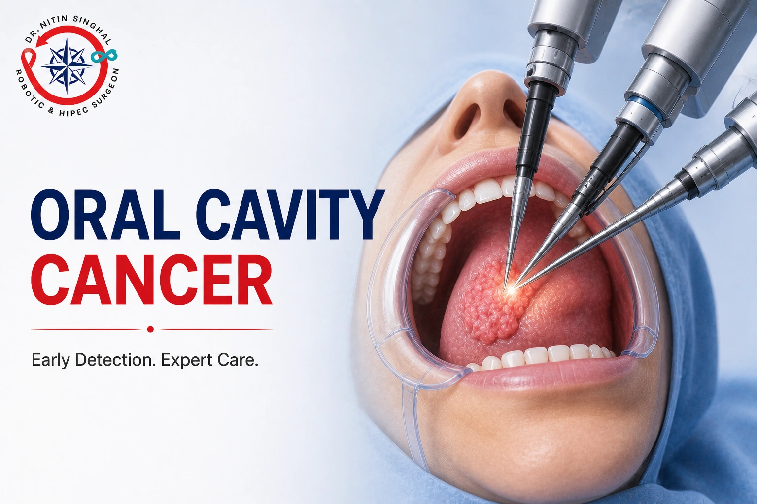 Oral Cavity Cancer, Dr Nitin Singhal Ahmedabad