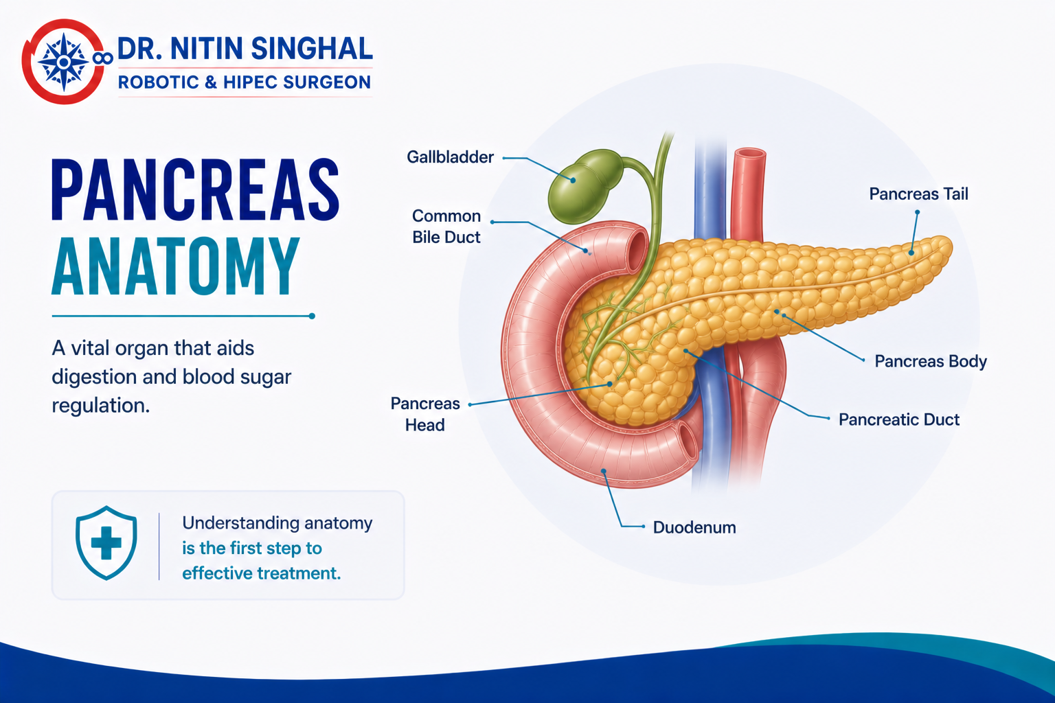 Robotic pancreatic cancer surgery — Dr. Nitin Singhal, Ahmedabad