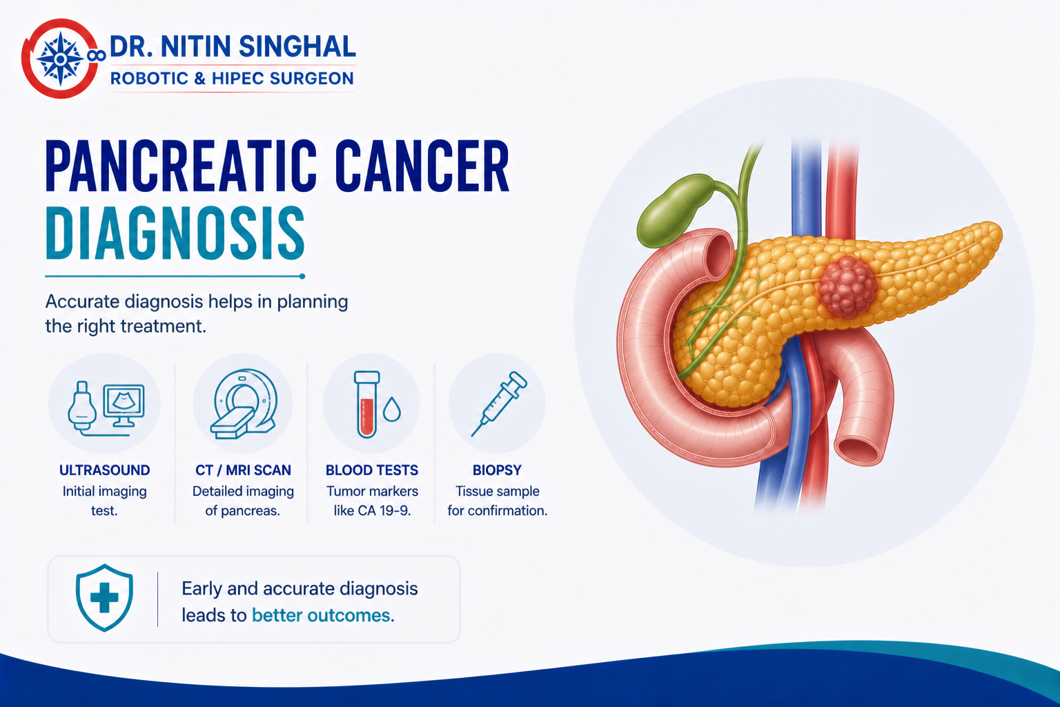 Pancreatic cancer diagnosis illustration