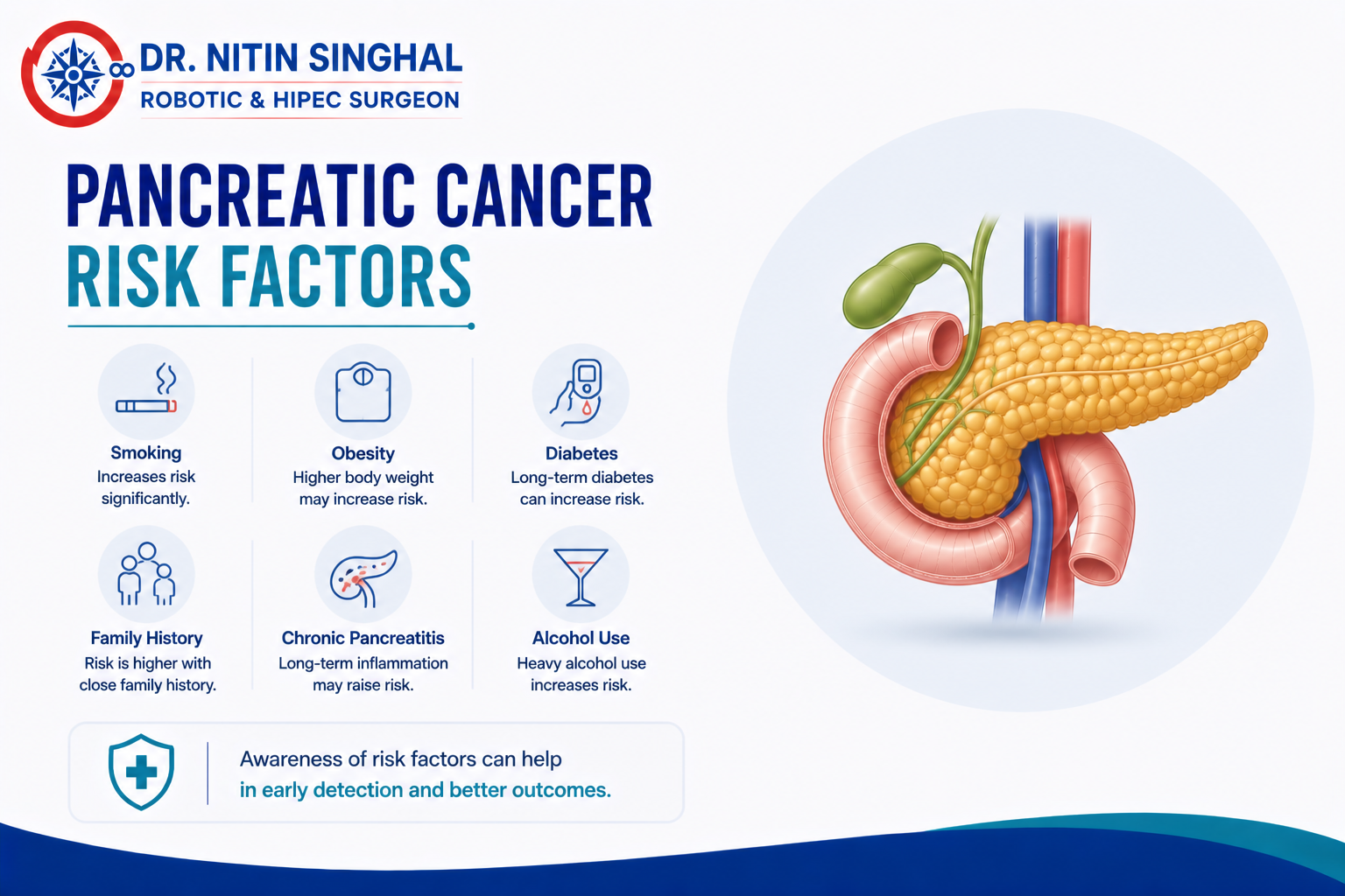Pancreatic cancer risk factors illustration
