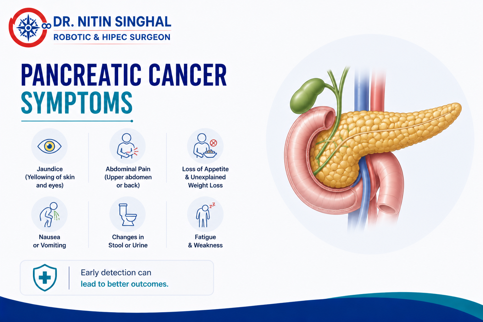 Pancreatic cancer symptoms illustration