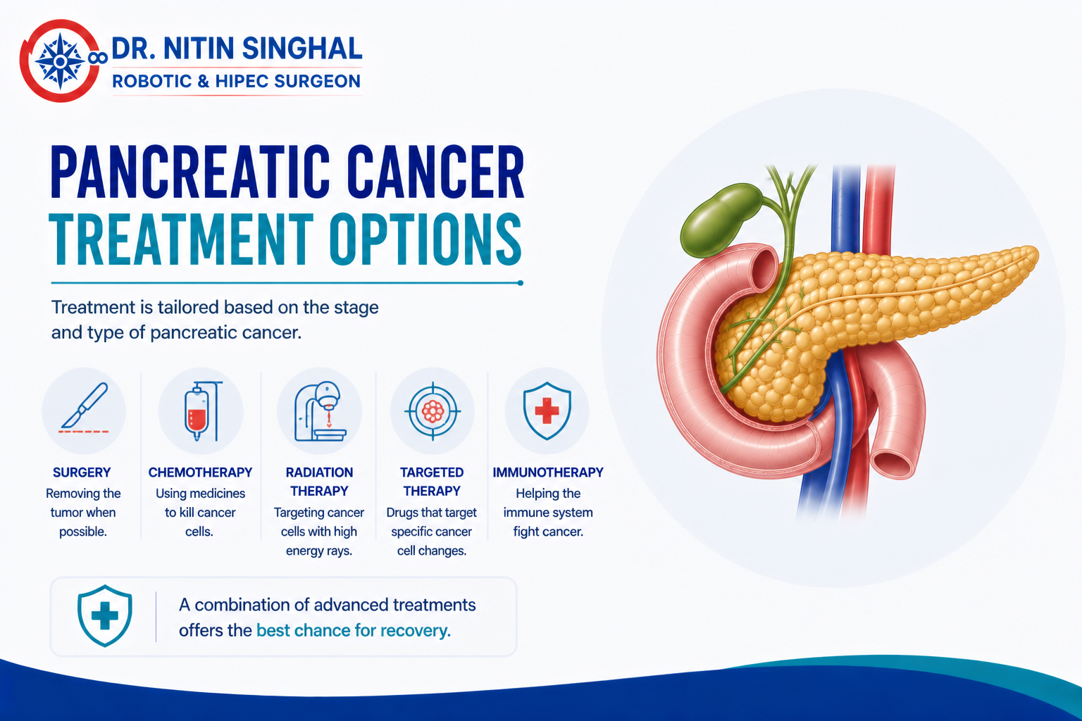 Pancreatic cancer treatment options illustration