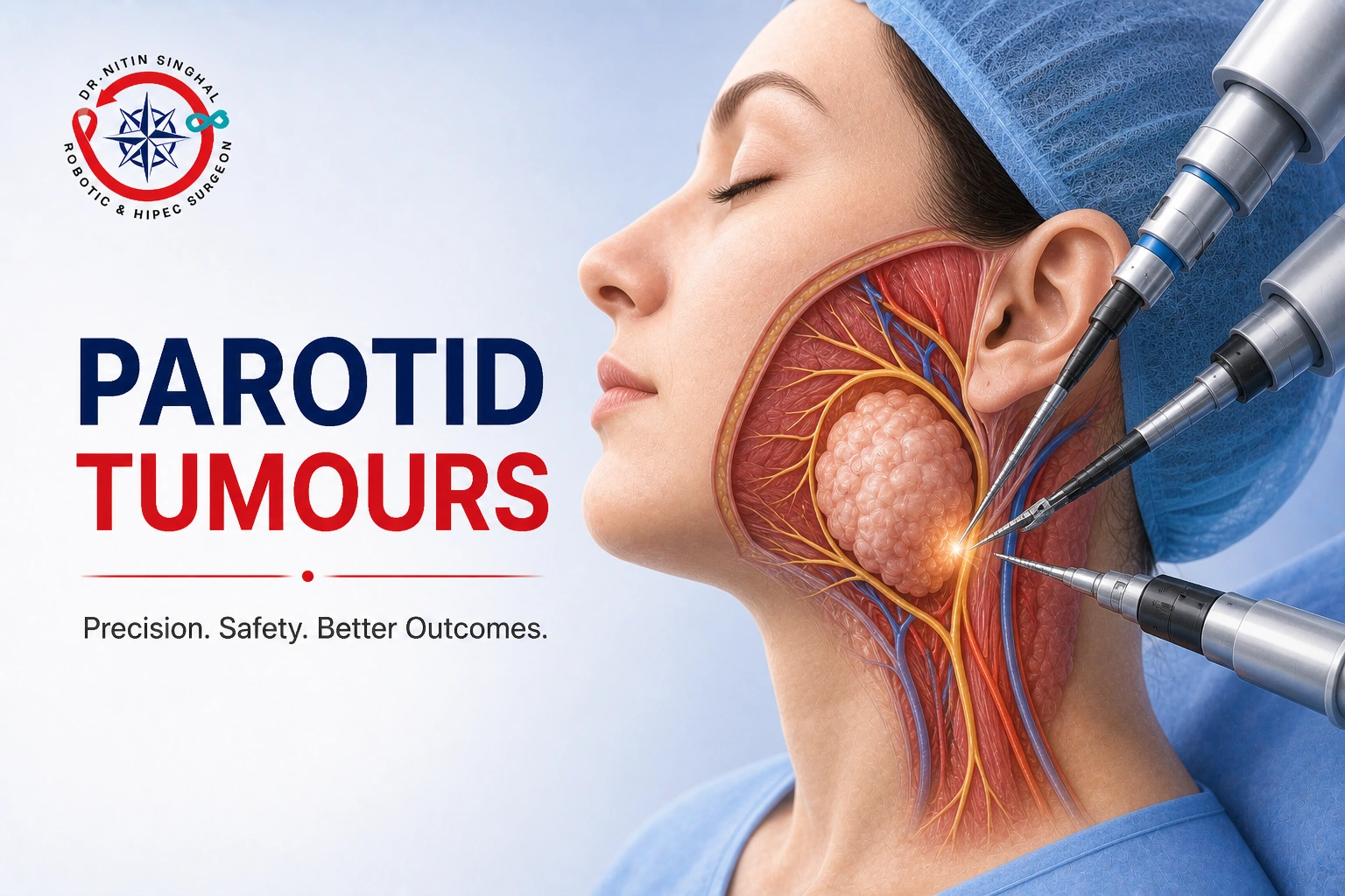 Parotid Tumours, Dr Nitin Singhal Ahmedabad