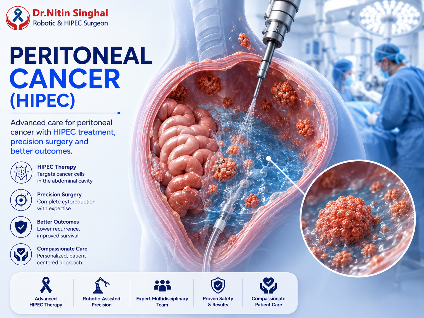 Peritoneal surface malignancy and HIPEC illustration, Dr. Nitin Singhal Robotic and HIPEC Surgeon
