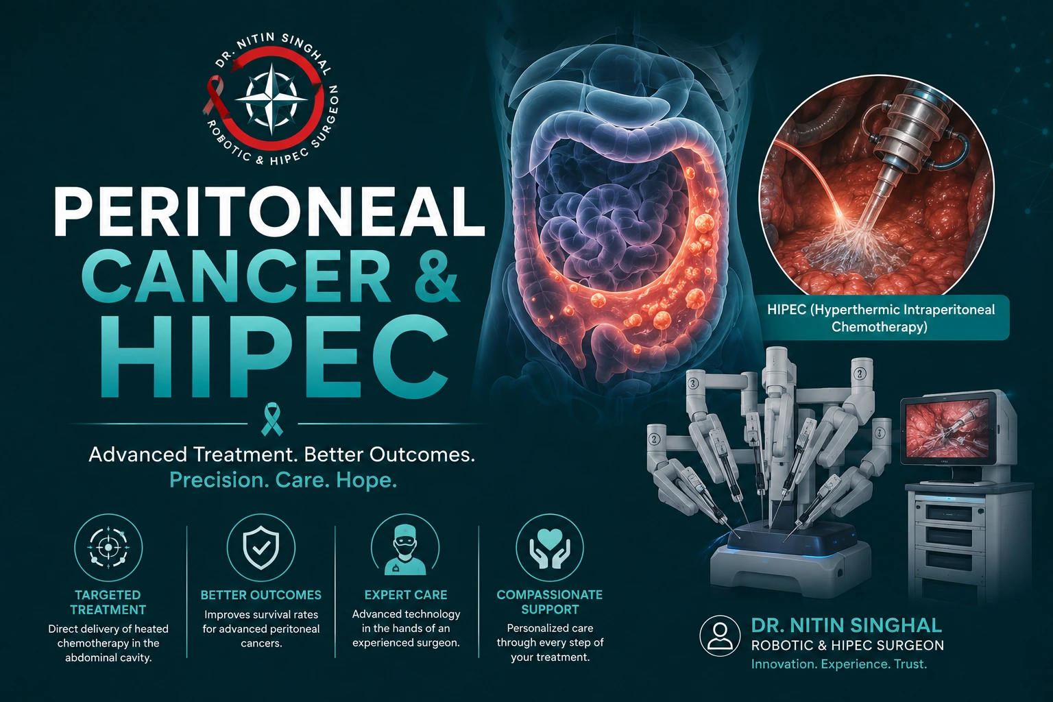 Peritoneal cancer and HIPEC — Dr. Nitin Singhal, Ahmedabad
